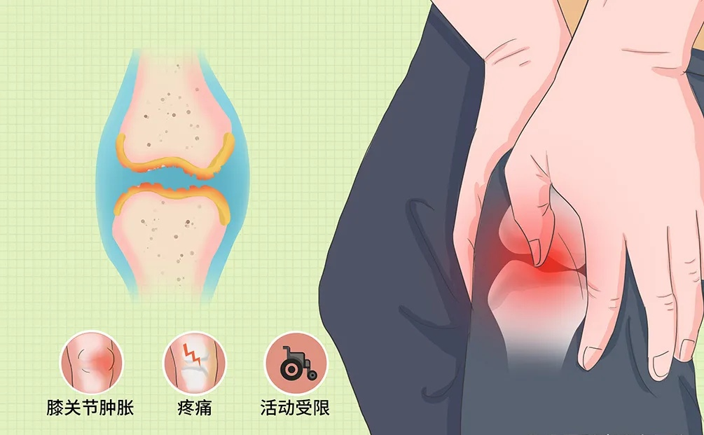 【惠景科普】冬季膝盖养护指南