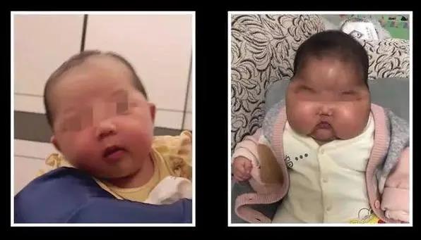 “大头娃娃”再现，教你一眼看穿“毒药膏”！