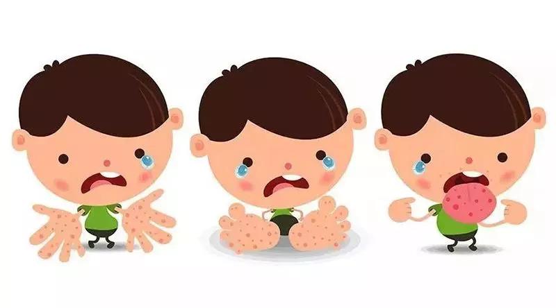 儿科门急诊快挤不下了！如何让手足口患儿少受罪？