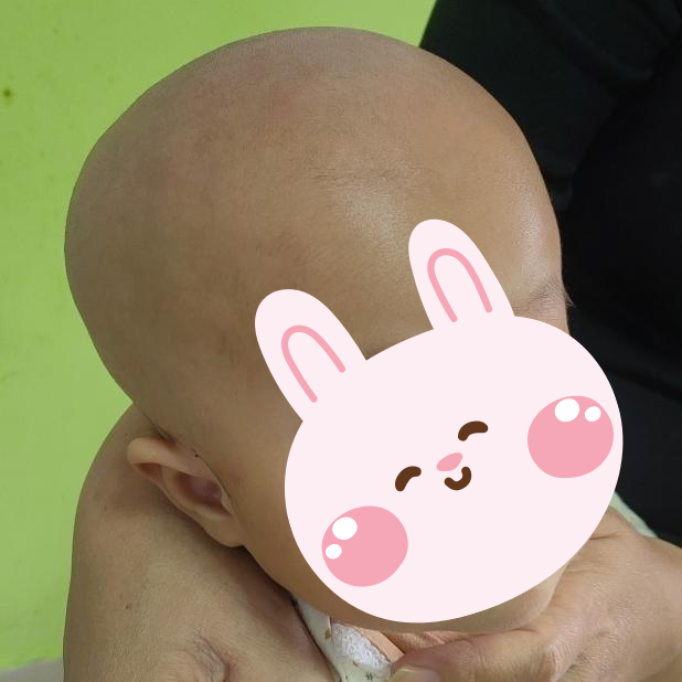 6个月“大头宝宝”跨城求医，刷新医院最低龄V-P分流纪录