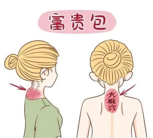 你是人间“富贵花”？还是“富贵包”？