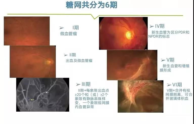 这隐形的视力杀手您知多少?