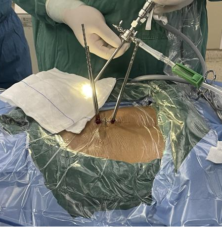 UBE技术，解决顽固性腰腿痛