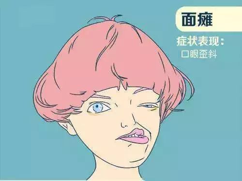 突发面瘫，元凶竟是耳朵