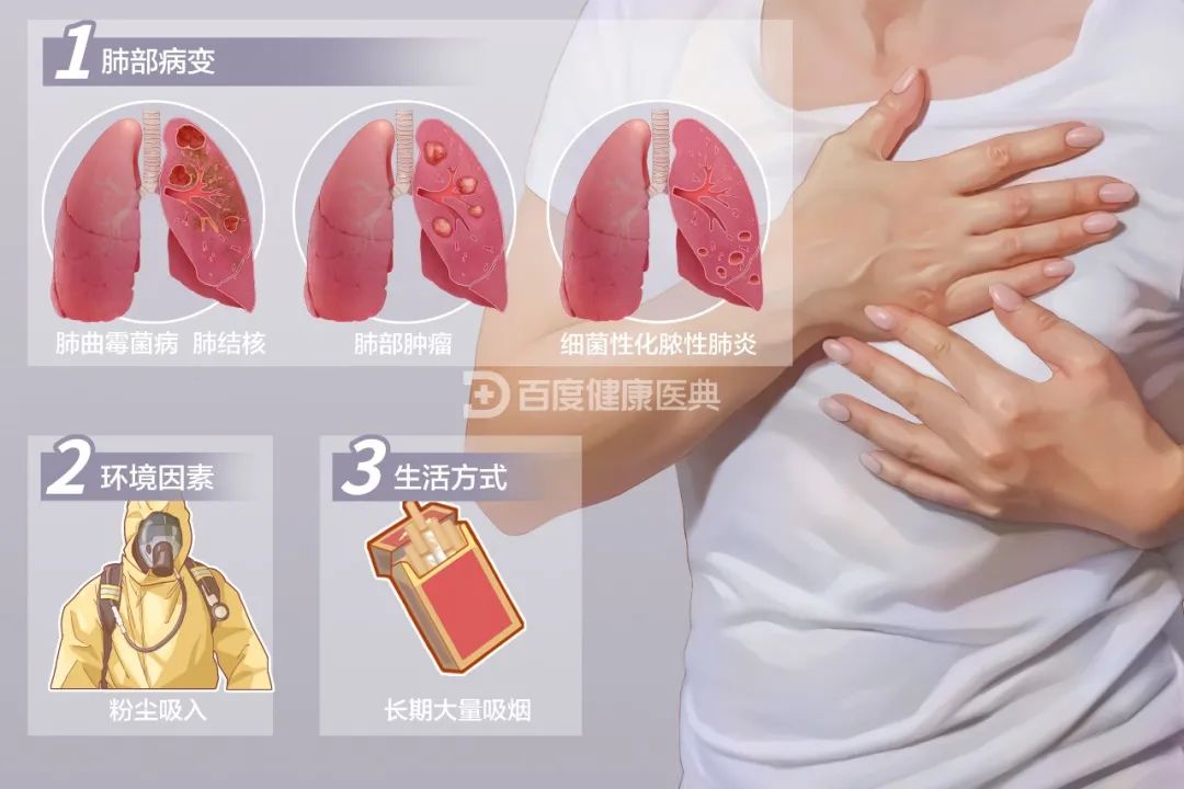肺结节是肿瘤吗？别让结节成“心结”！