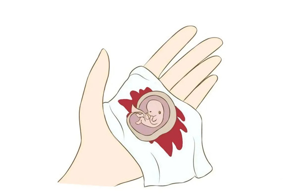 http://www.xtivf.com/upfile/2022/02/1645497559514.jpg