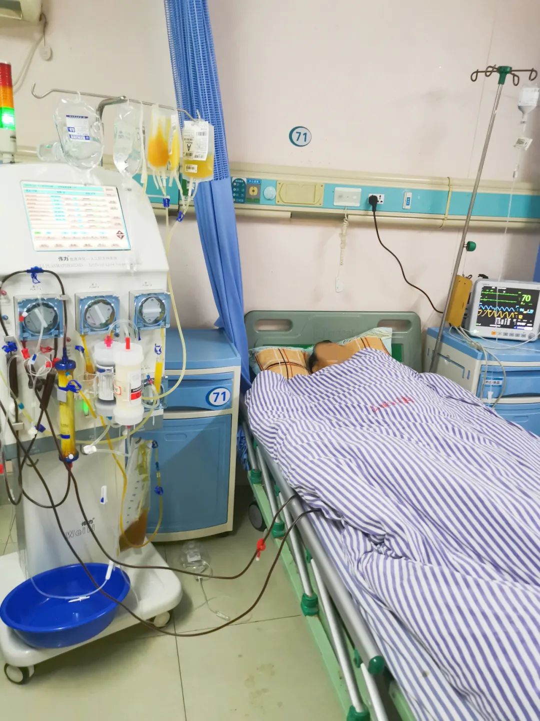 湘潭市中心医院运用“人工肝”技术成功救治一例重症甲亢危象合并肝衰竭患者